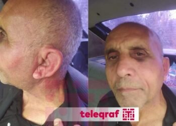 Psixiatriya Xəstəxanasında pasiyent döyülüb? – Rəsmi