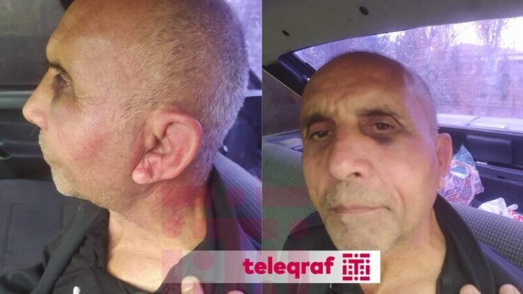 Psixiatriya Xəstəxanasında pasiyent döyülüb? – Rəsmi