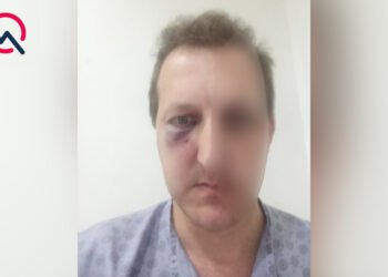 Bakıda Xalq artistinin oğlu döyüldü: saxlanılan var