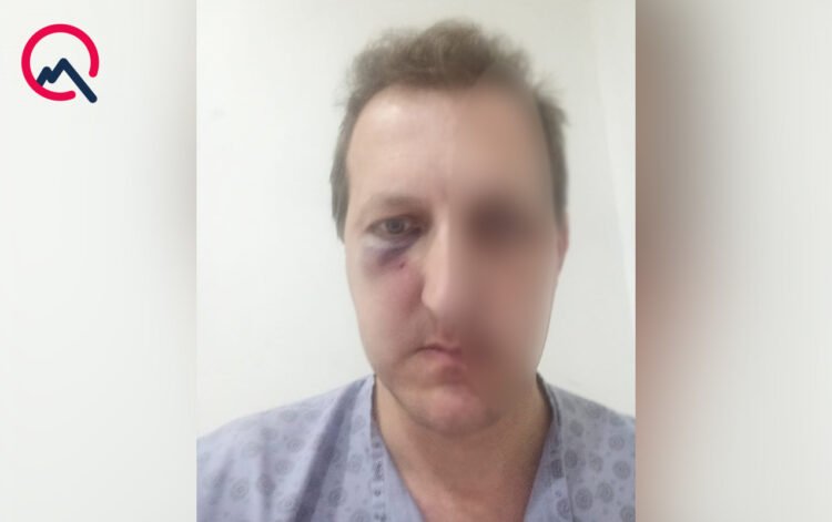 Bakıda Xalq artistinin oğlu döyüldü: saxlanılan var