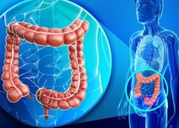 DİQQƏT: Bağırsaq xərçənginə yoluxmaq istəmirsinizsə, bu qaydalara mütləq əməl edin