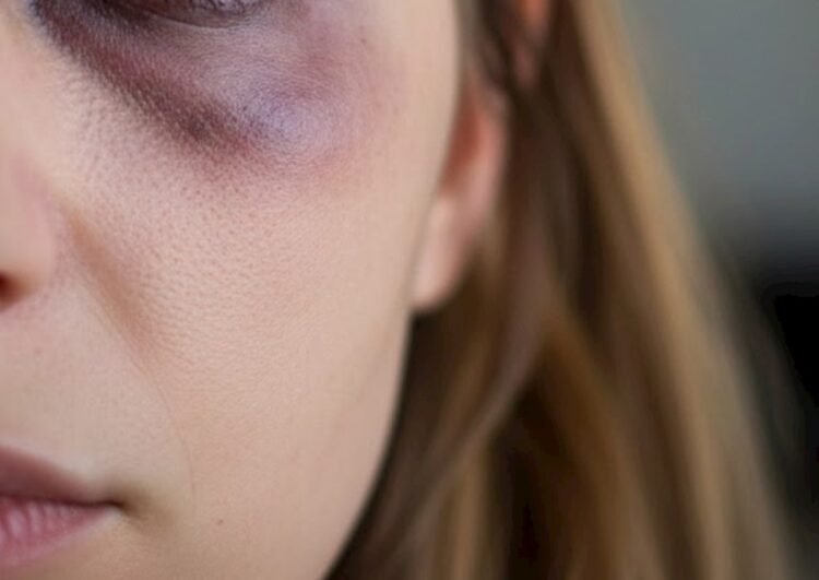 Gecə 1-də sevgilisini döydü — Söyüşə görə…