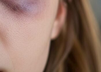 SON DƏQİQƏ: Bakıda aktyorun anası döyüldü