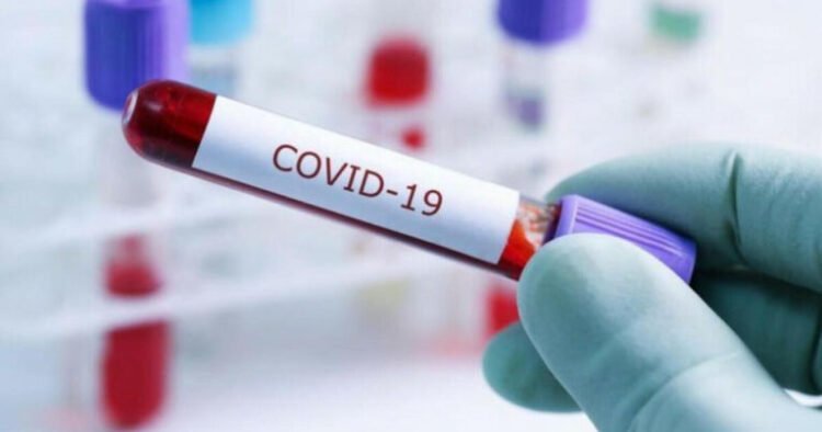 COVID-19-dan ölənlərin sayı 7 milyonu keçdi