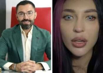 Bakıda göz rəngini dəyişdirdi, görməsi zəiflədi – Moskvalı qadın peşmandır – VİDEO