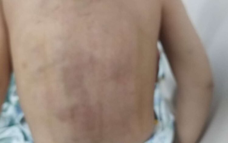 Lənkəranda atalığı 3 yaşlı uşağı vəhşicəsinə döydü – FOTO