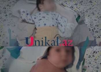 Ananın qolları olmayan körpəsindən imtina etməsi ilə bağlı – Rəsmi açıqlama