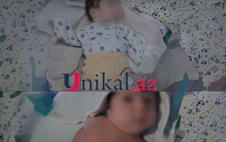 Ananın qolları olmayan körpəsindən imtina etməsi ilə bağlı – Rəsmi açıqlama