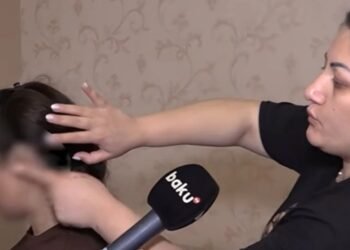 Həkim əməliyyatdan sonra tamponu xəstənin başında unutdu – VİDEO